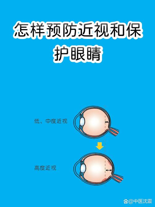 怎样预防近视和保护眼睛